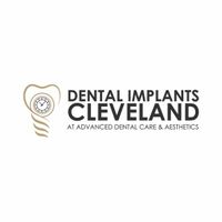 dentalimplants